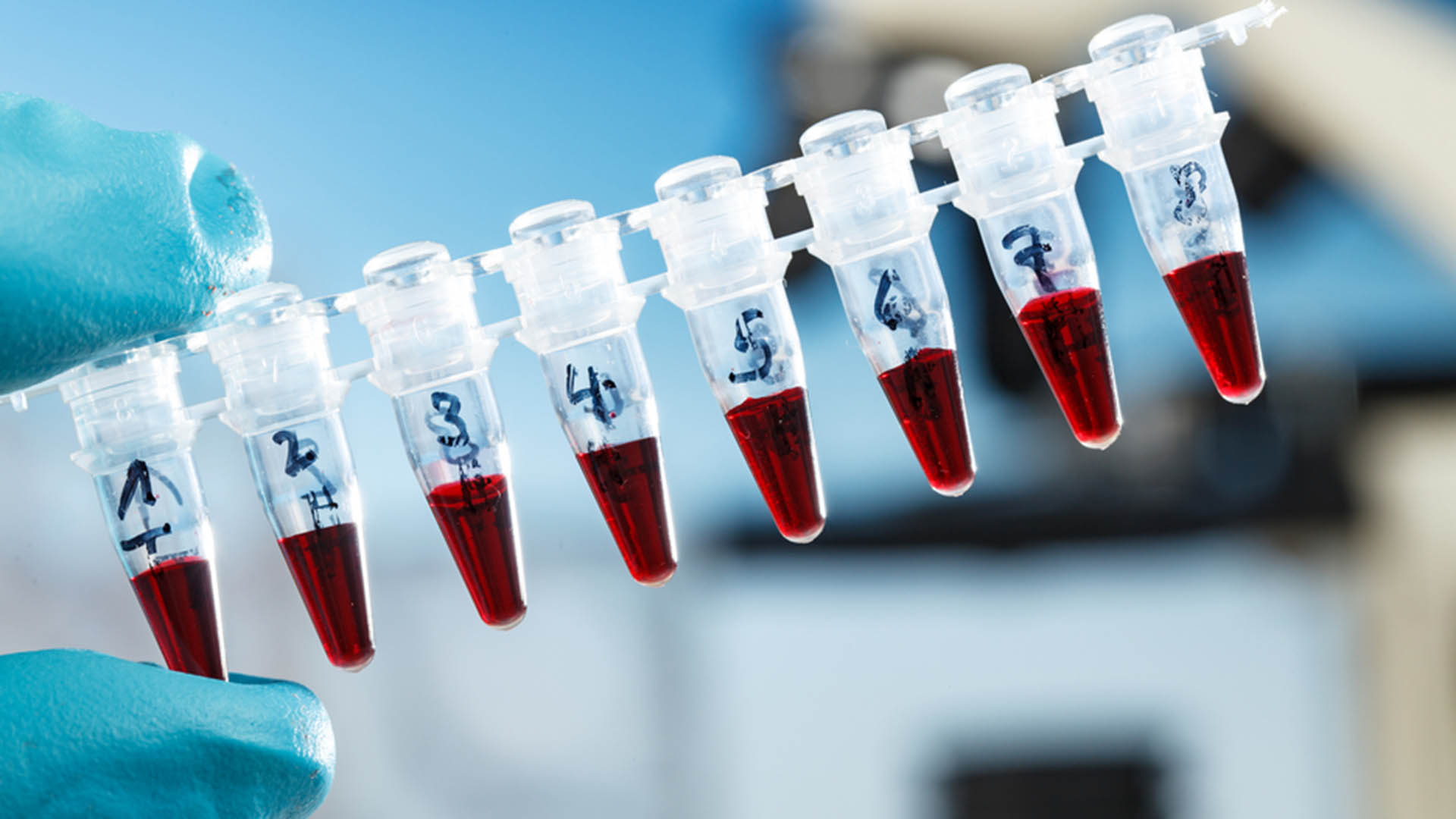 [COVID] – Test PCR – Préparation et test (1/2)